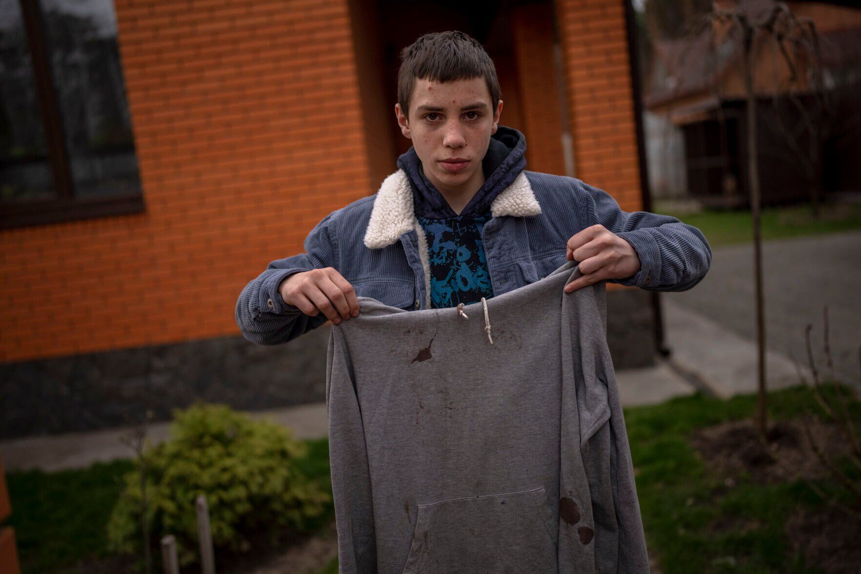 Russia Ukraine War The Boy Who Survived